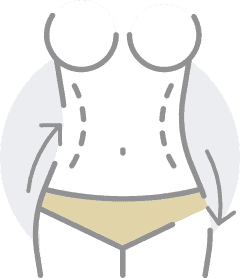 Body remodeling​